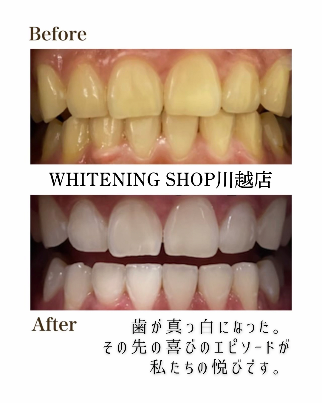 ホワイトニングショップ川越店